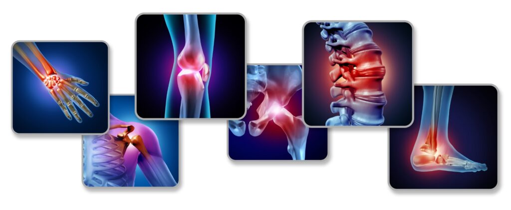 combattere osteoporosi con magnetoterapia professionale